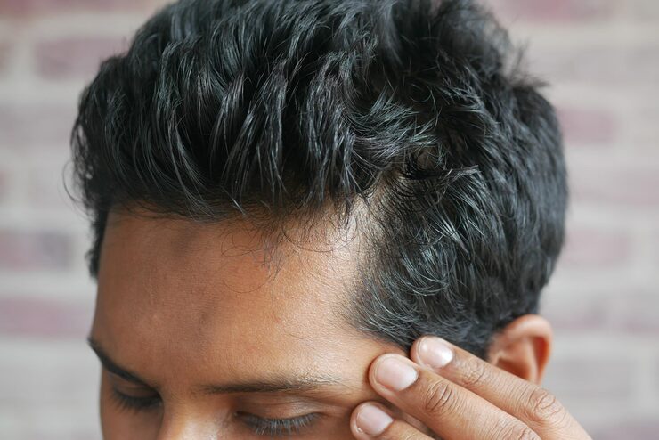 Hair Loss & Hair Thinning